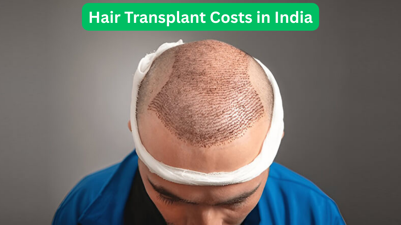 Hair Transplant Costs in India