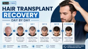 Hair Transplant Recovery Day by Day