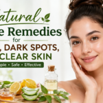 Natural Home Remedies for Acne
